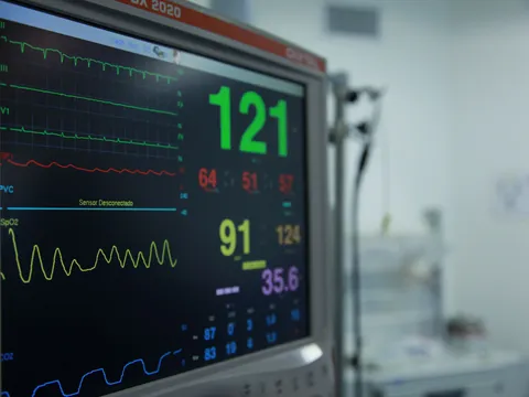 A patient monitor showing heart rate and oxygen readings